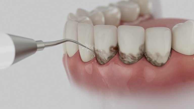 Trusted Teeth Cleaning And Checkup service in Sundance, WY - Dentist Open Now